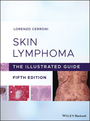 Skin Lymphoma: The Illustrated Guide, 5th Edition