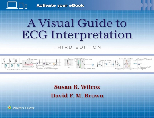 A Visual Guide to ECG Interpretation 3rd edition