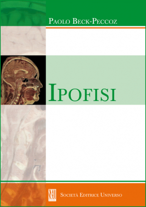 Ipofisi