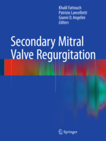 Secondary Mitral Valve Regurgitation