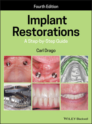 Implant Restorations: A Step-by-Step Guide, 4th Edition