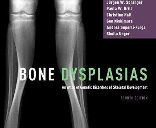 Bone Dysplasias