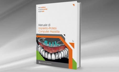 Manuale di Implanto-Protesi Computer Assistita