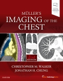 Muller's Imaging of the Chest, 2nd Edition