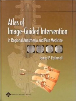 Atlas of Image-guided Intervention in Regional Anesthesia And Pain Medicine 