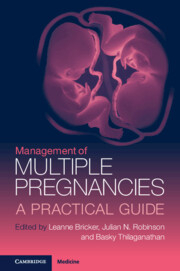 Management of Multiple Pregnancies A Practical Guide