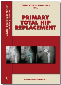 Primary Total Hip Replacement N. 3