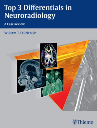 Top 3 Differentials in Neuroradiology 1st ed