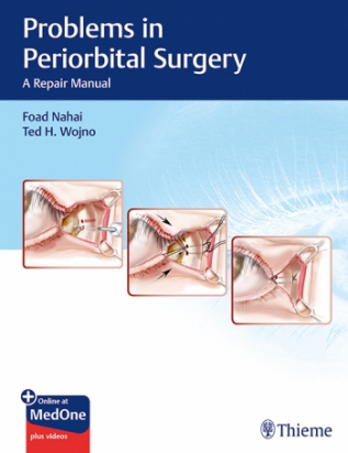 Problems in Periorbital Surgery  with videos online