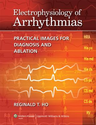 Electrophysiology of Arrhythmias 
