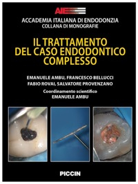 Il Trattamento del Caso Endodontico Complesso