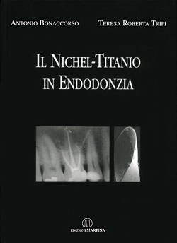 Il Nichel-Titanio in Endodonzia