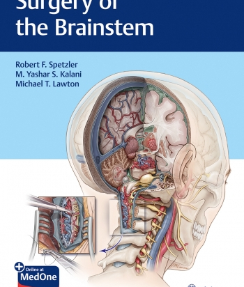 Surgery of the Brainstem