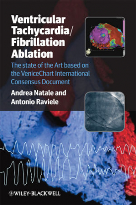 Ventricular Tachycardia / Fibrillation Ablation