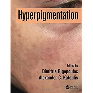 Hyperpigmentation