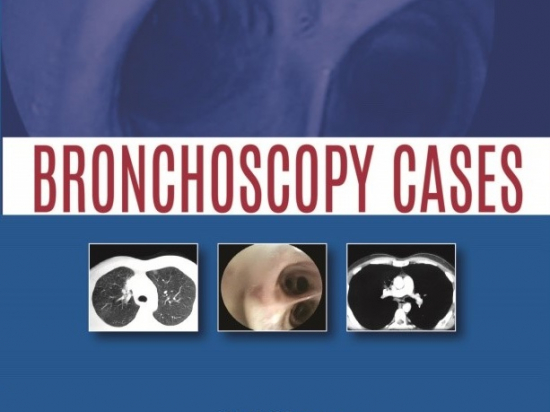 Bronchoscopy Cases