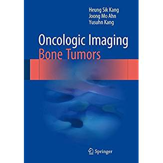 Oncologic Imaging: Bone Tumors