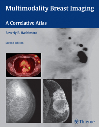 Multimodality Breast Imaging