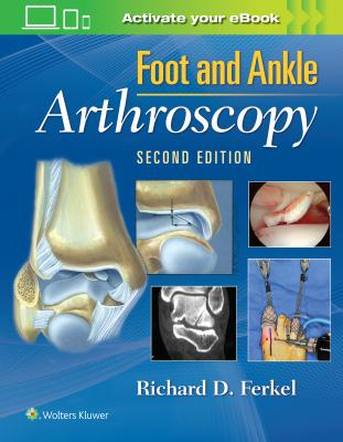 Foot &amp; Ankle Arthroscopy, 2e