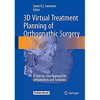 3D Virtual Treatment Planning of Orthognathic Surgery