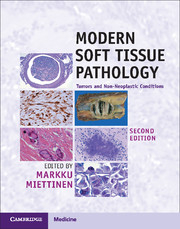 Modern Soft Tissue Pathology - 2nd Edition