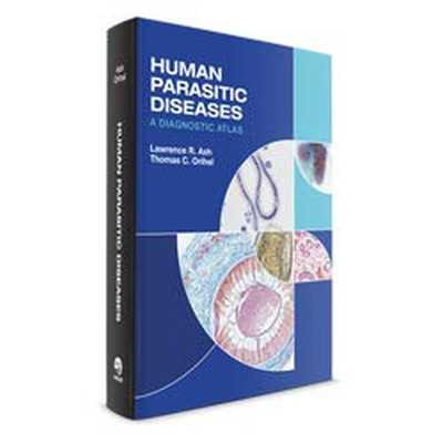 Human Parasitic Diseases