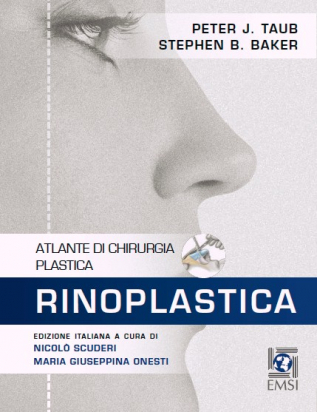 Rinoplastica 