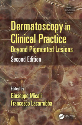 Dermatoscopy in Clinical Practice, Second Edition