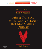 Atlas of Normal Roentgen Variants That May Simulate Disease, 9th Edition