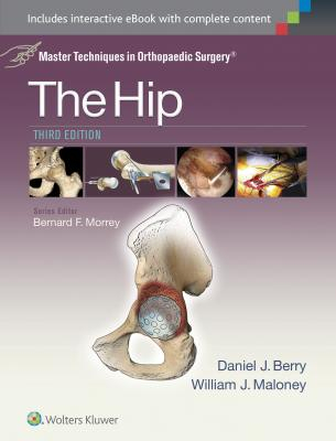 Master Techniques in Orthopaedic Surgery: The Hip, 3e 