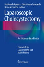 Laparoscopic Cholecystectomy