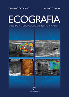 Ecografia