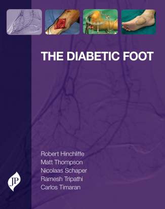 The Diabetic Foot