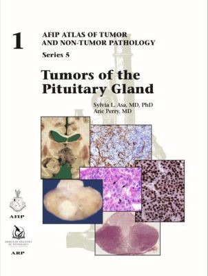 AFIP Series 5 Fasc. 1 Tumors of the Pituitary Gland