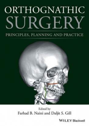 Orthognathic Surgery: Principles, Planning and Practice