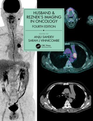 Husband &amp; Reznek's Imaging in Oncology- 4th edition