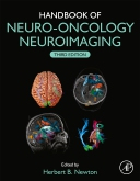 Handbook of Neuro-Oncology Neuroimaging, 3rd Edition