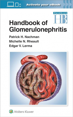 Handbook of Glomerulonephritis First edition