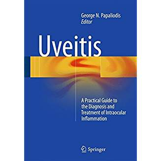 Uveitis