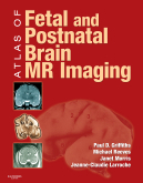 Atlas of Fetal and Postnatal Brain MR