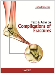 Text &amp; Atlas on Complications of Fractures