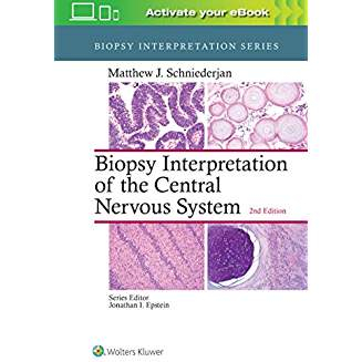 Biopsy Interpretation of the Central Nervous System, 2e