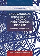 Endovascular Treatment of Chronic Deep Venous Disease Principles and practice
