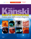 Signs in Ophthalmology: Causes and Differential Diagnosis