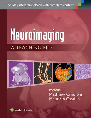 Neuroimaging: A Teaching File 