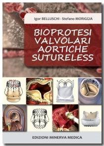 Bioprotesi valvolari aortiche sutureless