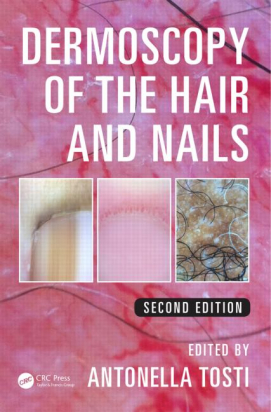 Dermoscopy of the Hair and Nails, Second Edition