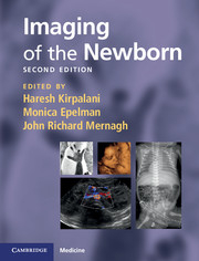 Imaging of the Newborn