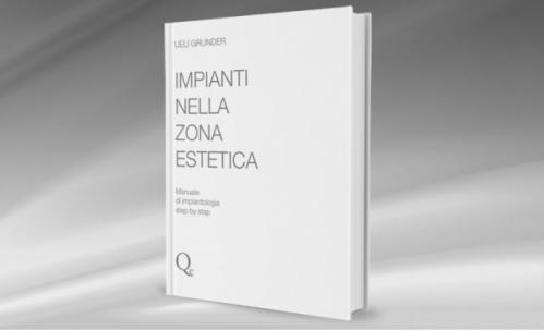 Impianti nella zona estetica