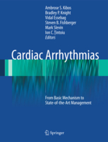 Cardiac Arrhythmias